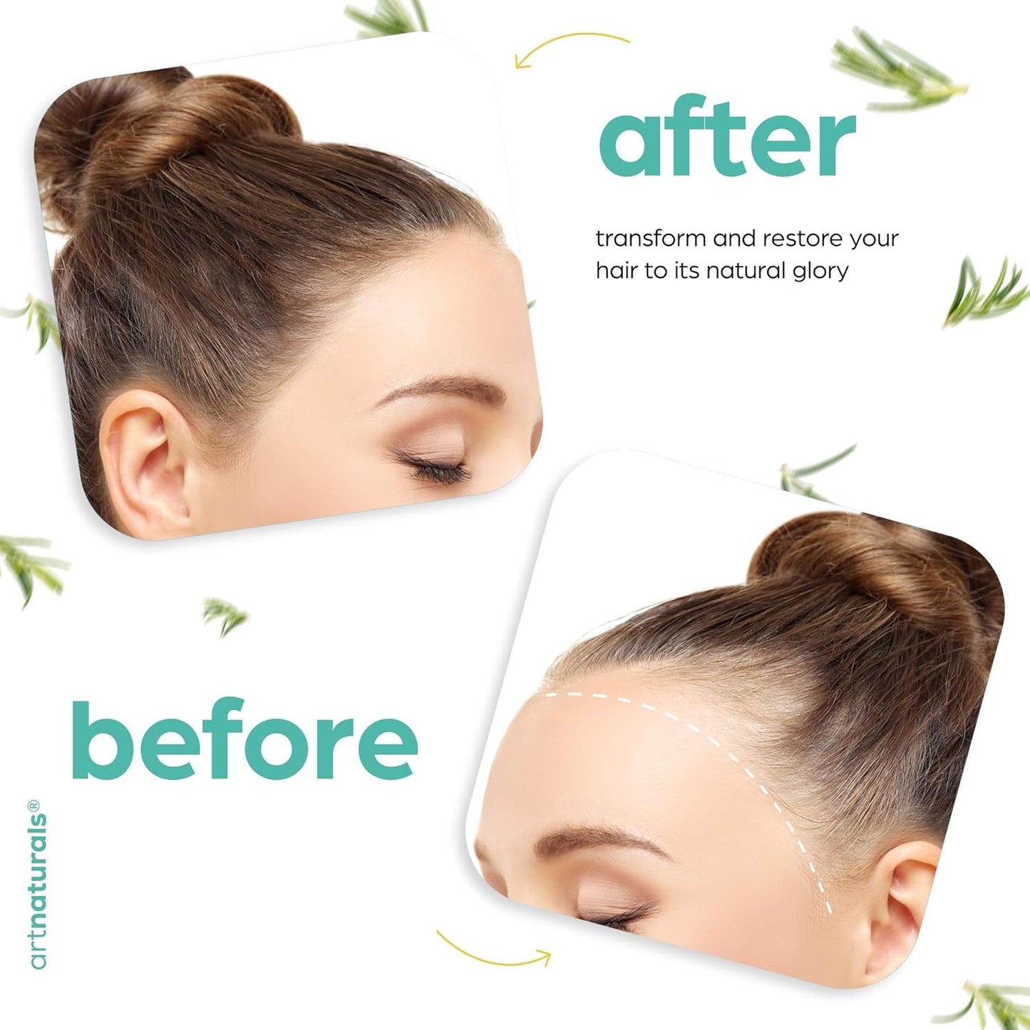 Artnaturals ekologiškas rozmarino ir ricinos aliejus plaukų augimui + galvos odos masažuoklis