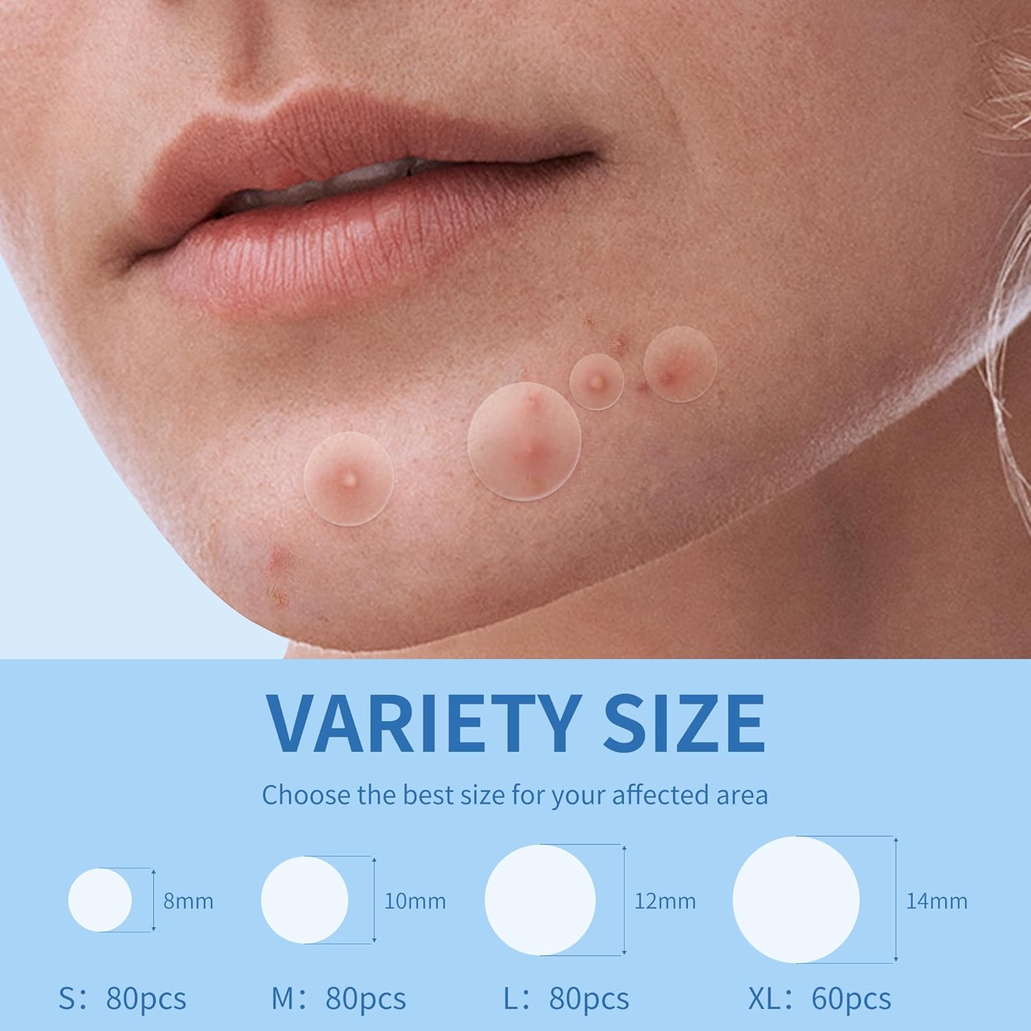 Spuogų pleistriukai, 300 vnt.