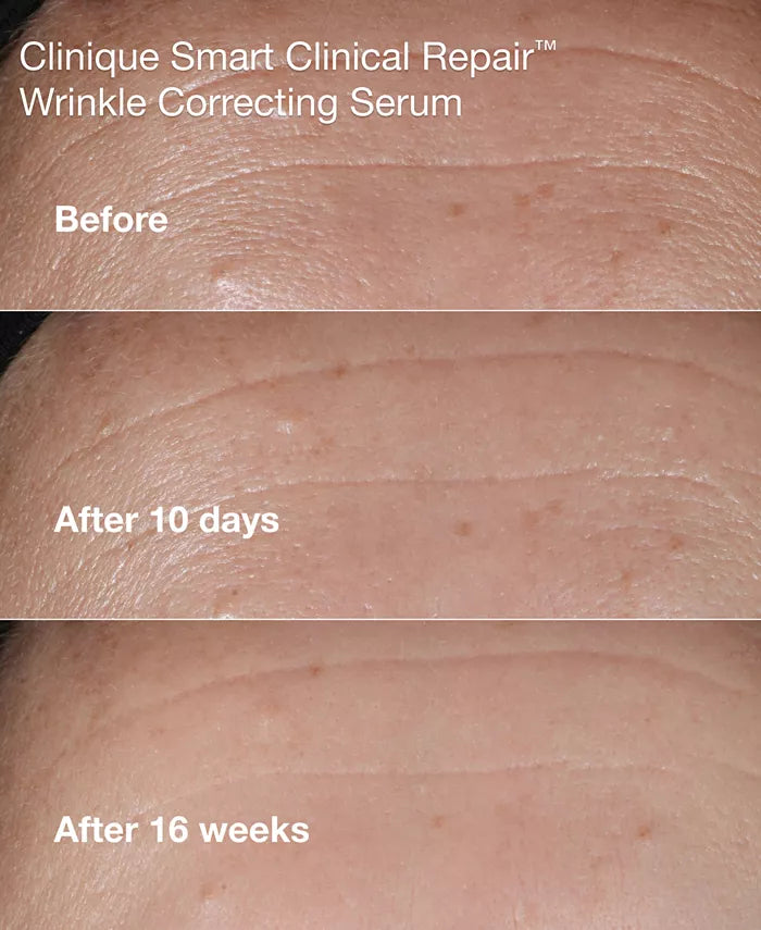 CliniqueNuo ryto iki Vakaro išmanusis klinikinis atsatymas 