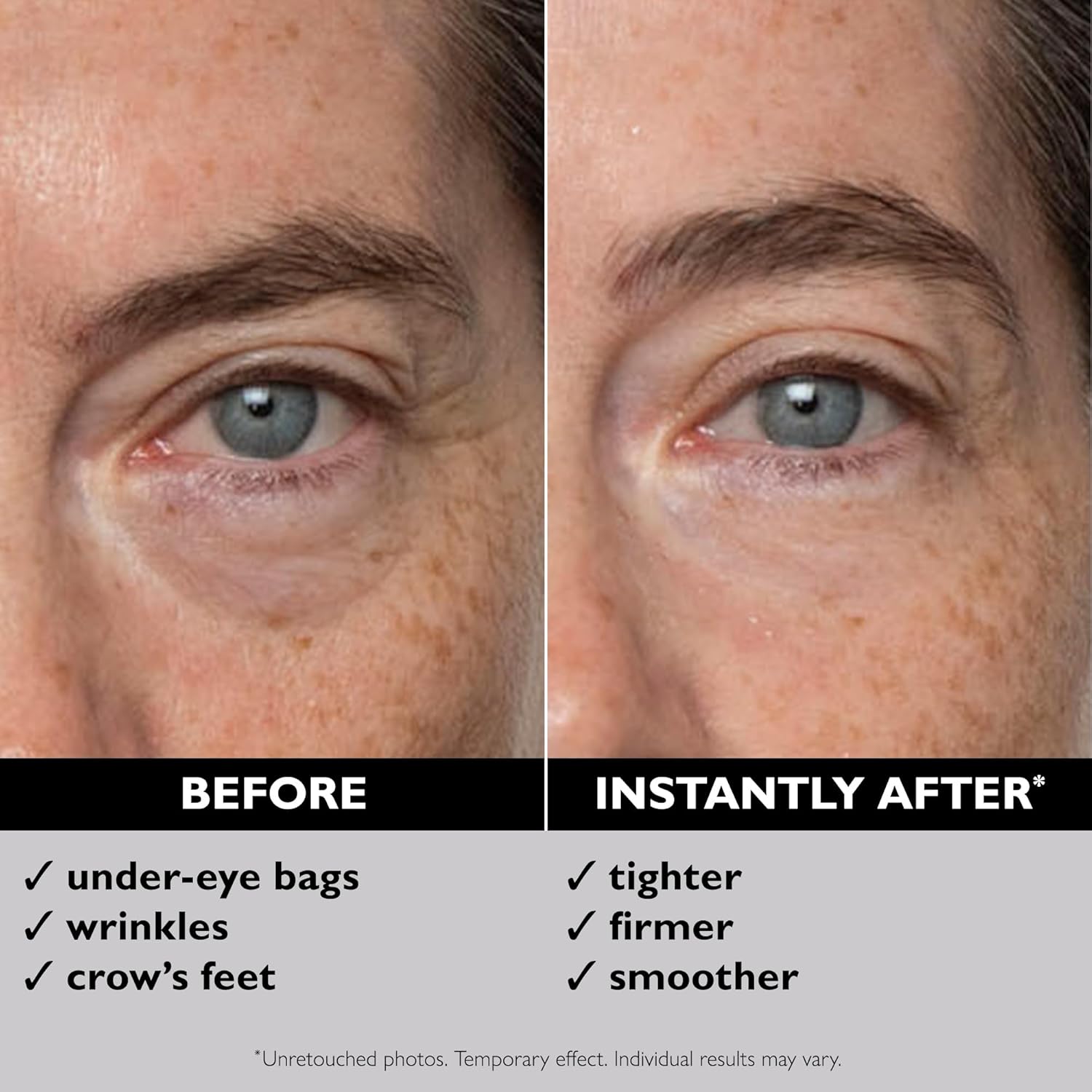 Peter Thomas Roth Instant FIRMx Temporary Eye Tightener paakių stangrinamasis kremas, 30 ml