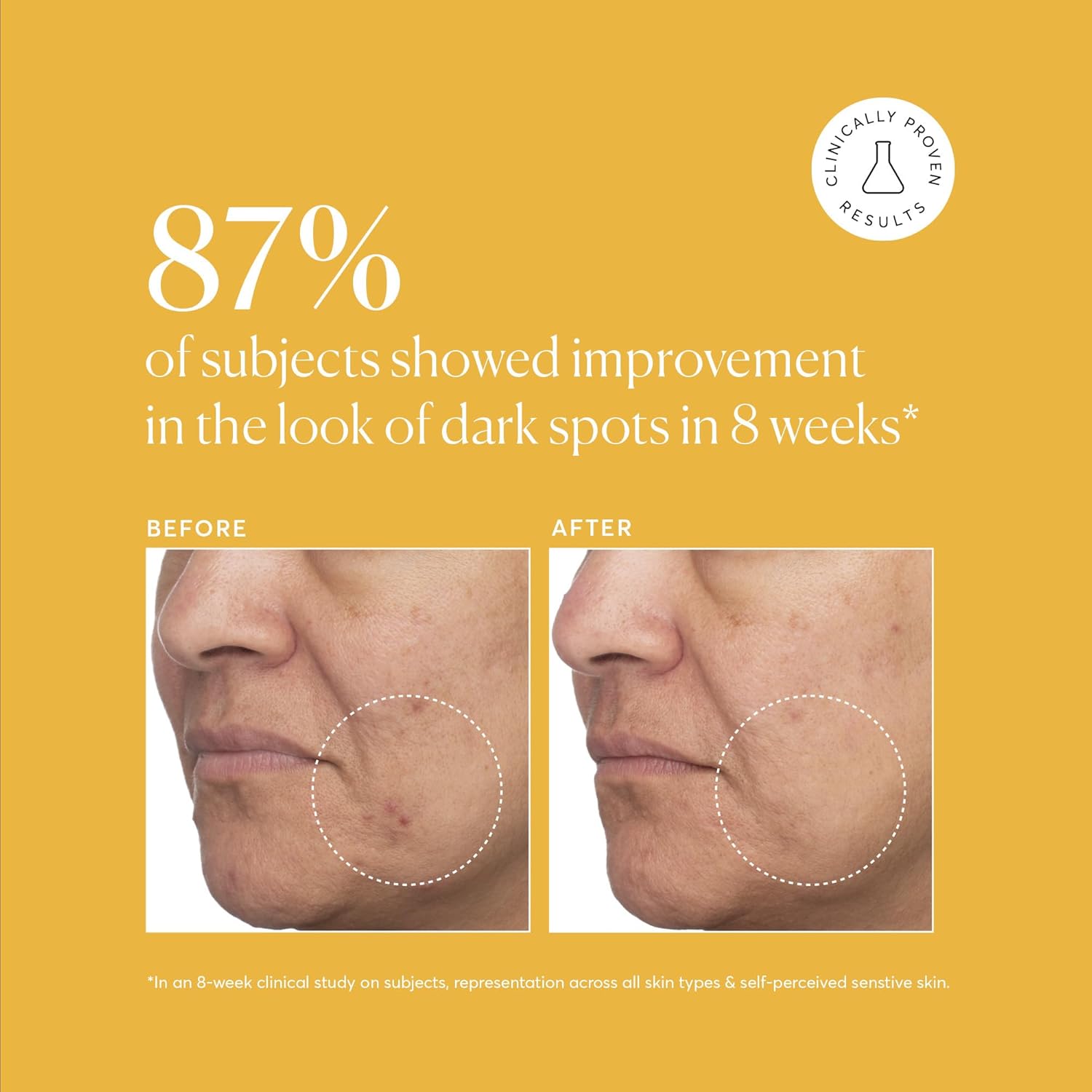 Naturium Tranexamic Topical Acid 5% serumas su kojine rūgštimi, niacinamidu ir saldymedžio šaknimi 