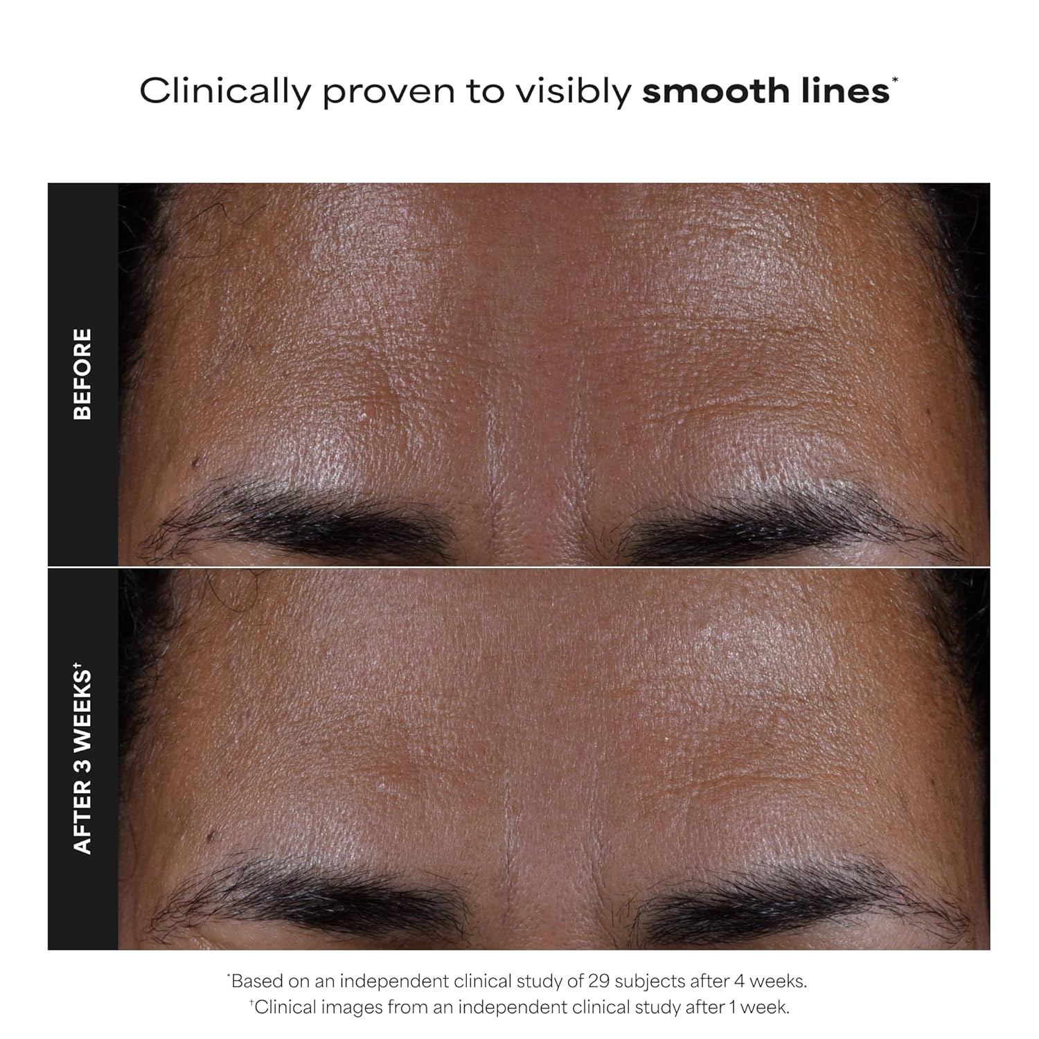 Paula's Choice SKIN PERFECTING 2% BHA skystas šveitiklis su salicilo rūgštimi