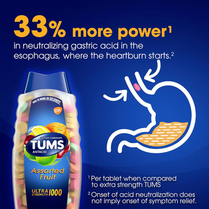 TUMS Ultra Strength kramtomosios tabletės nuo rėmens ir rūgštingumo, vaisių skonio, 160 vnt.